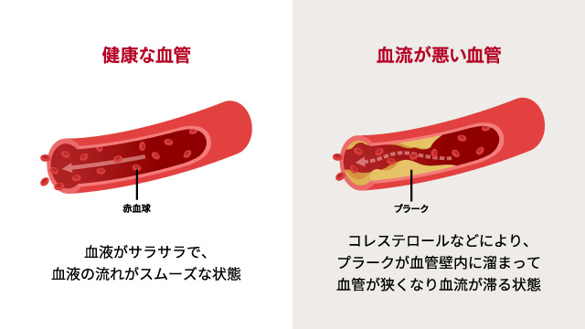 血流速度の向上