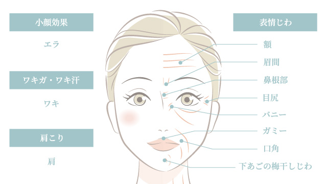 ボトックス注射の適応