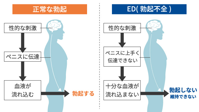 EDは原因により4つのタイプに分けられる